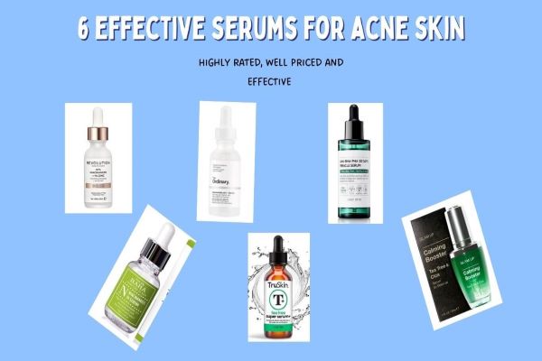 Highly rated serum for acne prone skin