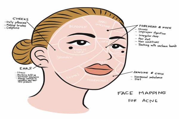 Acne face mapping