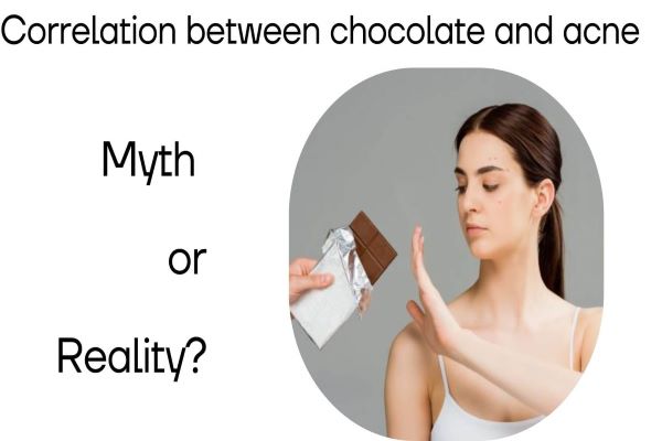 Acne and chocolate: Myth or Reality