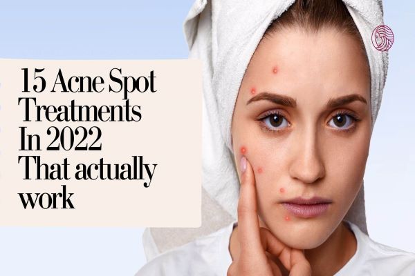 Acne spot treatments