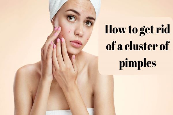 How to get rid of a cluster of pimples