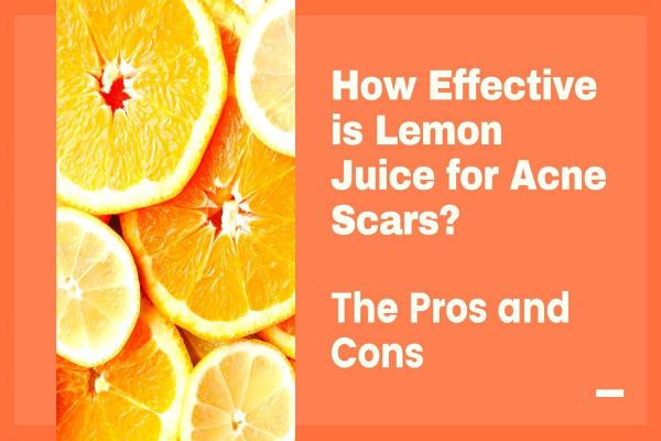 Lemon juice for acne scars