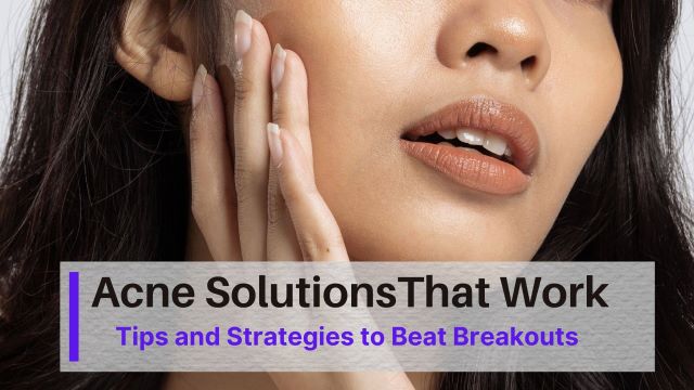 Acne Solutions That Work