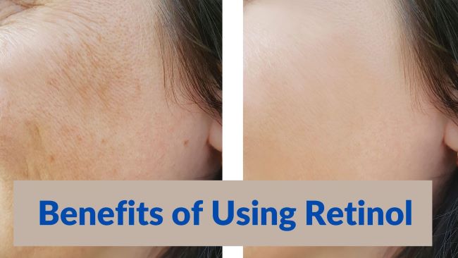 Peptides Vs Retinol: Benefits of Using Retinol