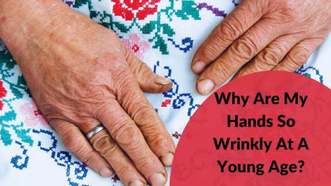 why-are-my-hands-so-wrinkly-at-a-young-age-skincare-for-acne