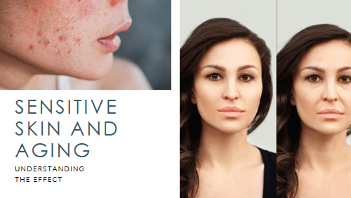 How Aging Affects Sensitive Skin Differently