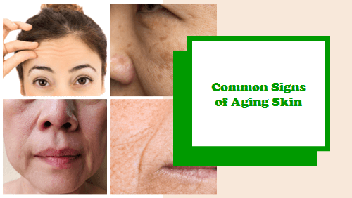 Some cocmmon signs of aging