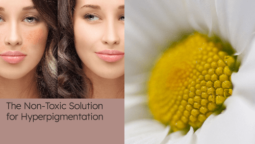 The Non-Toxic Solution for Hyperpigmentation